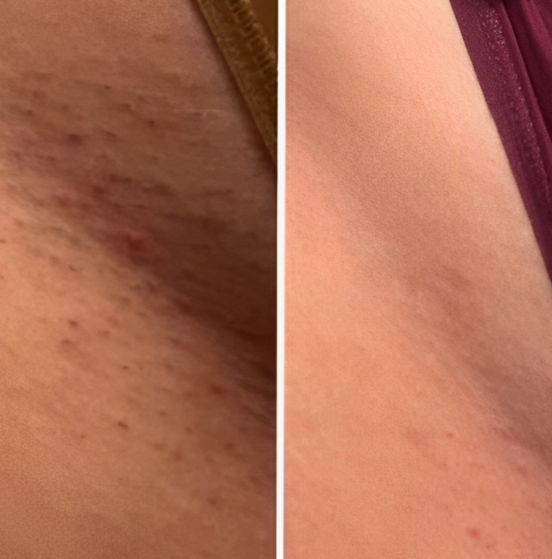 Elysia Ladyshave Dames - Draadloos Elektrisch Scheerapparaat voor Gevoelige Huid